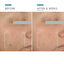LHA Serum (Formally Blemish + Age Defense Serum)