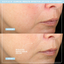 NuFace Trinity+ Pro Facial Toning Device